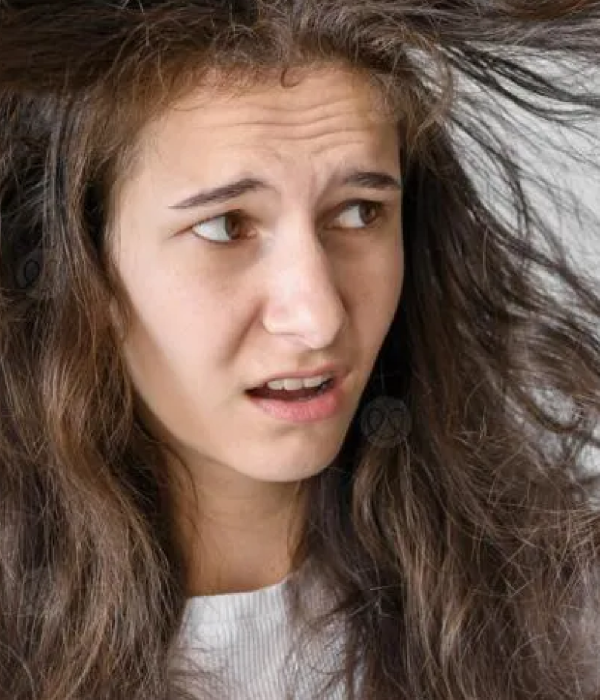 16_اضطراب شد خصل الشعر (Hair-pulling Disorder)